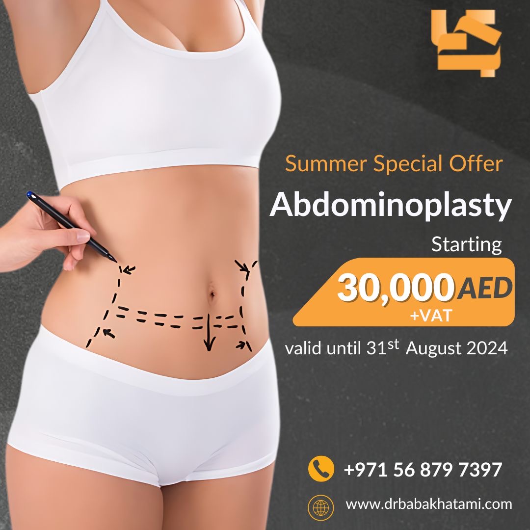 Abdominoplasty