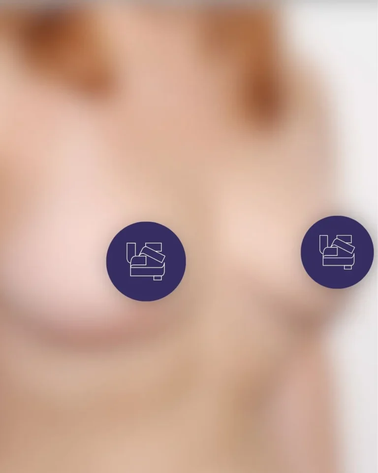 Breast Augmentation in Dubai