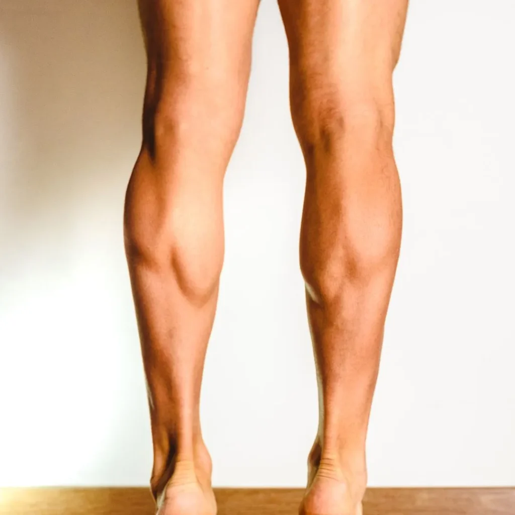 calf augmentation surgery in Dubai