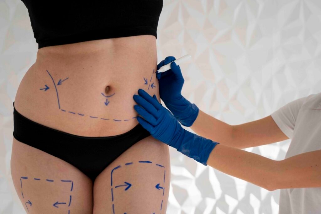What to eat after a tummy tuck: a complete guide for proper recovery 1 What to eat after a tummy tuck