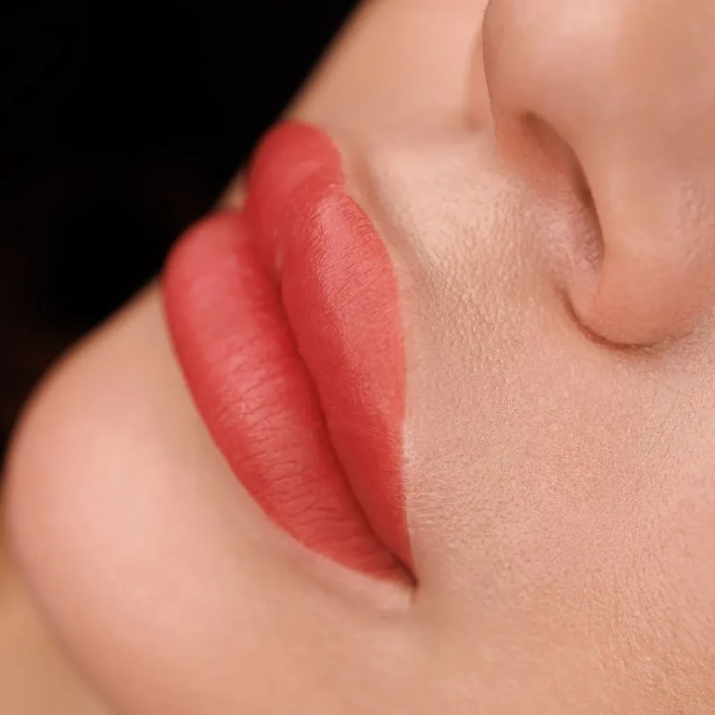 lip fillers in Dubai