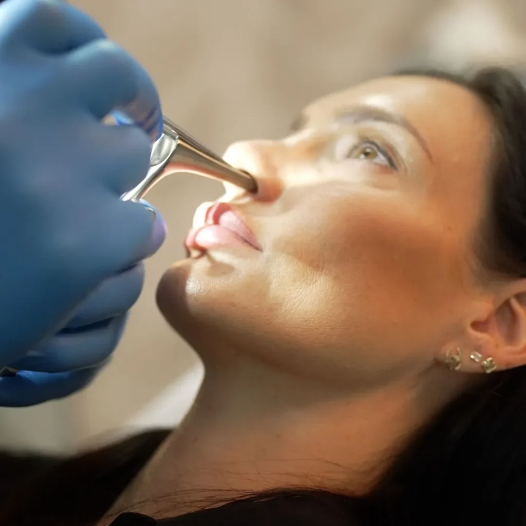 rhinoplasty in Dubai