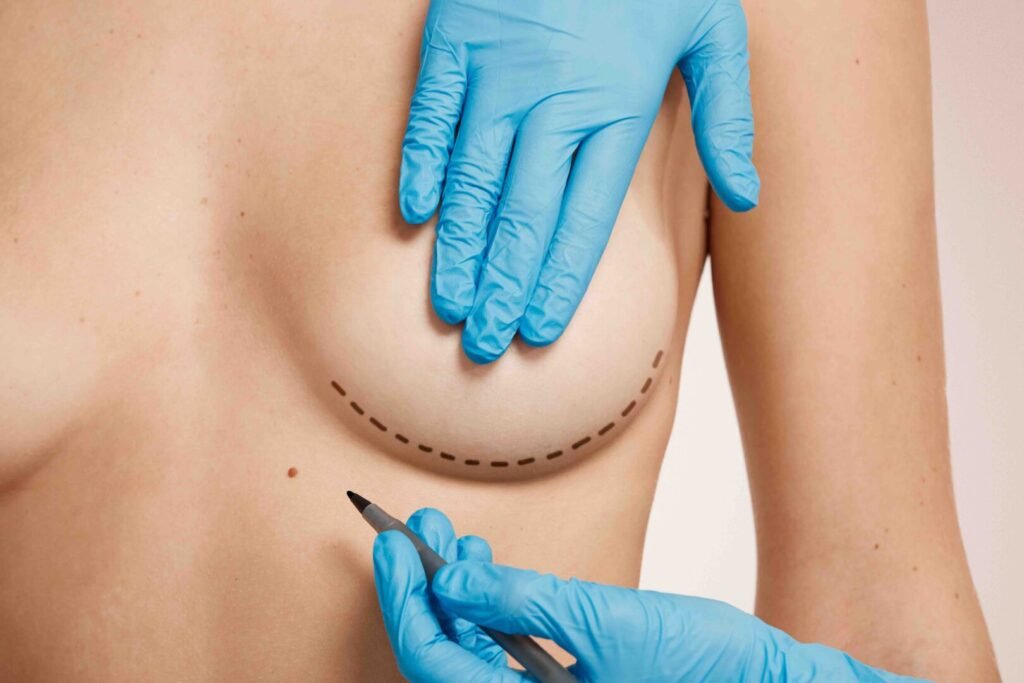 Pain after breast surgery: what to really expect during recovery 1 Pain after breast augmentation